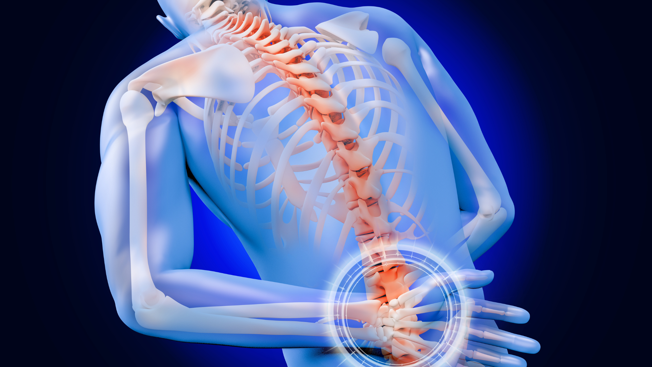 managing Sacroiliitis