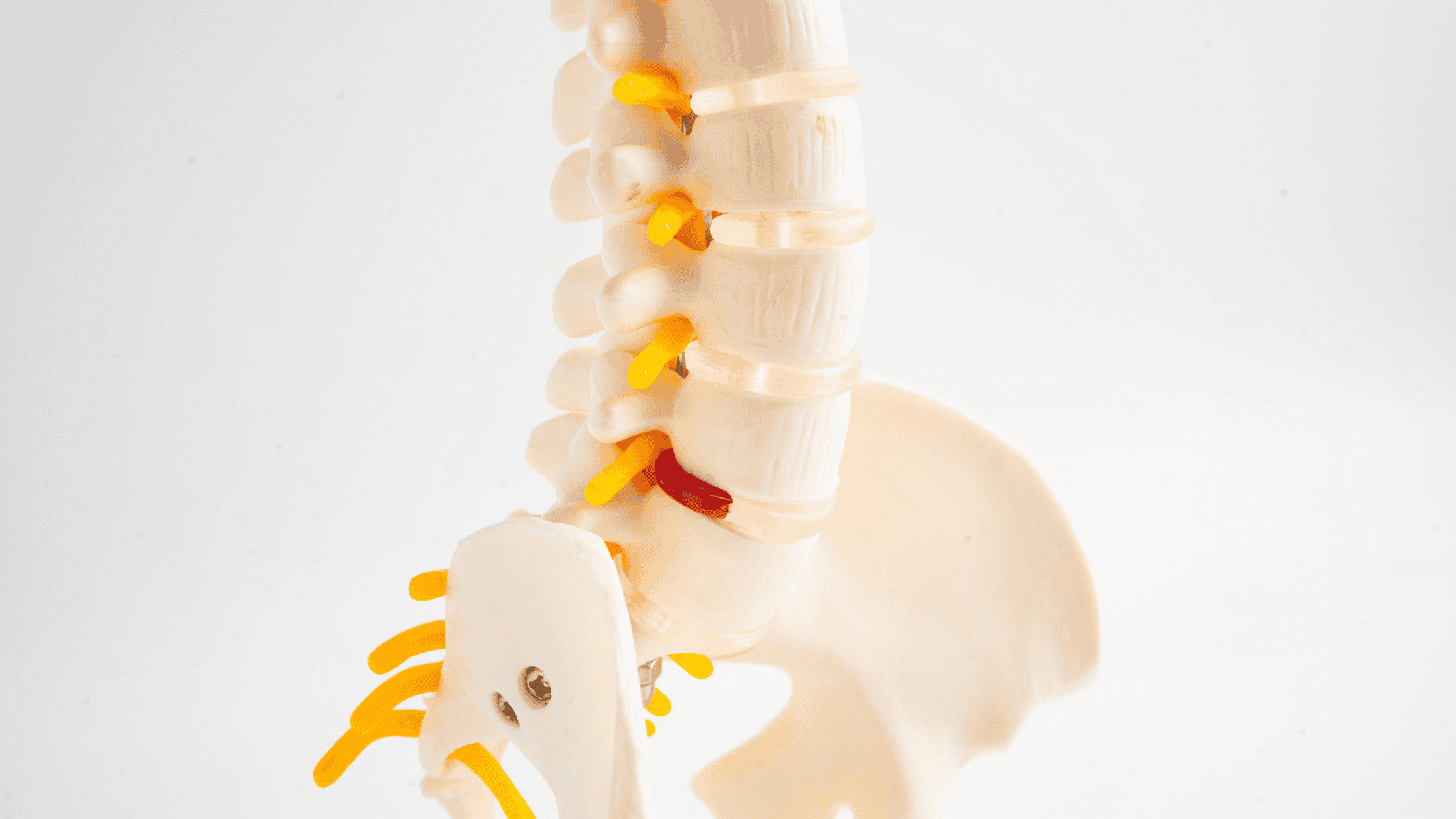 herniated disc pain